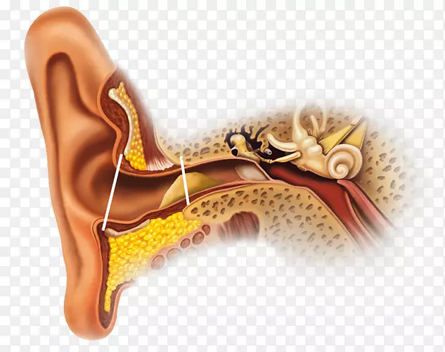 耳垢耳道腺分泌-耳