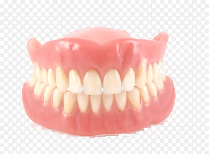 可摘局部义齿牙科种植体牙科实验室冠