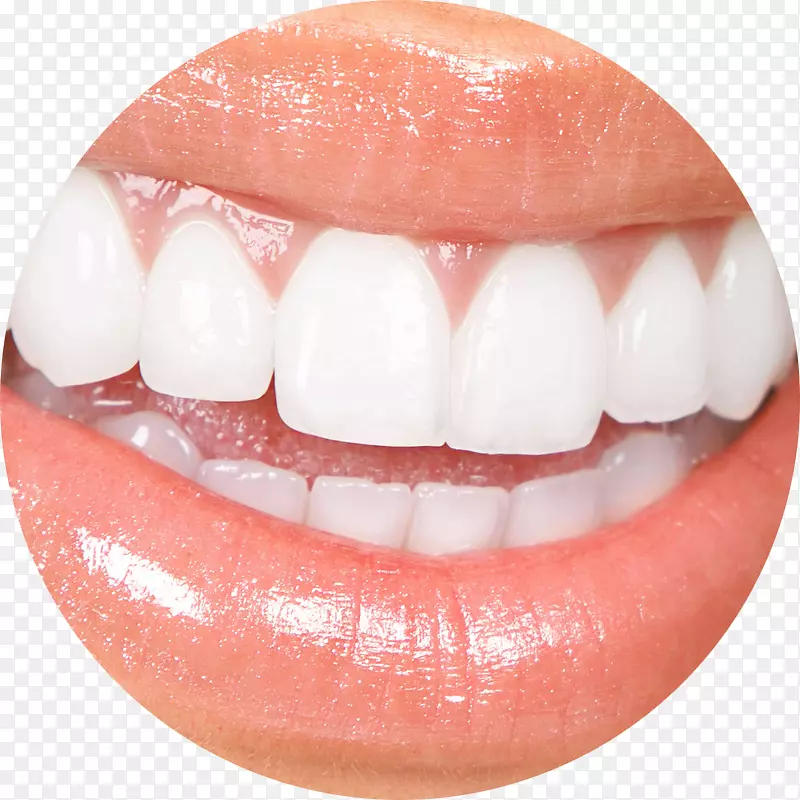 单面美容牙科牙齿美白-牙齿外科手术