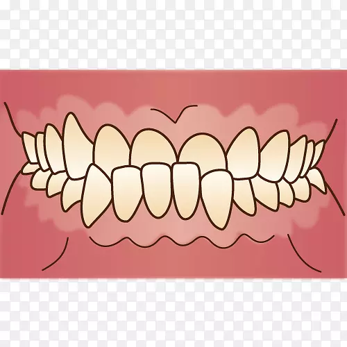 歯科错牙合牙医-正畸学