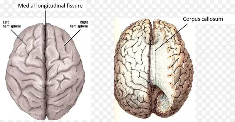 脑半球脑功能偏侧化