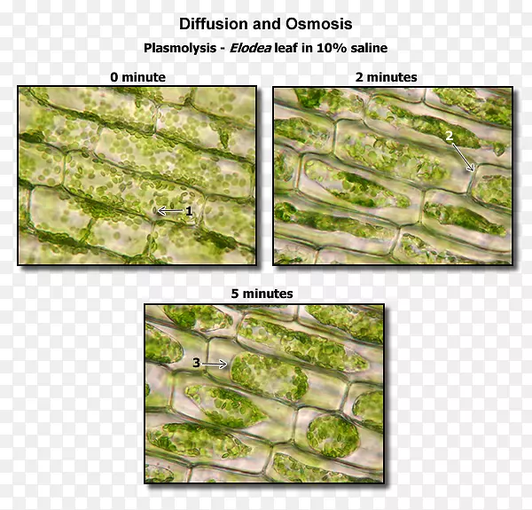 植物细胞胞浆溶解生物学-人体肌肉解剖疗法