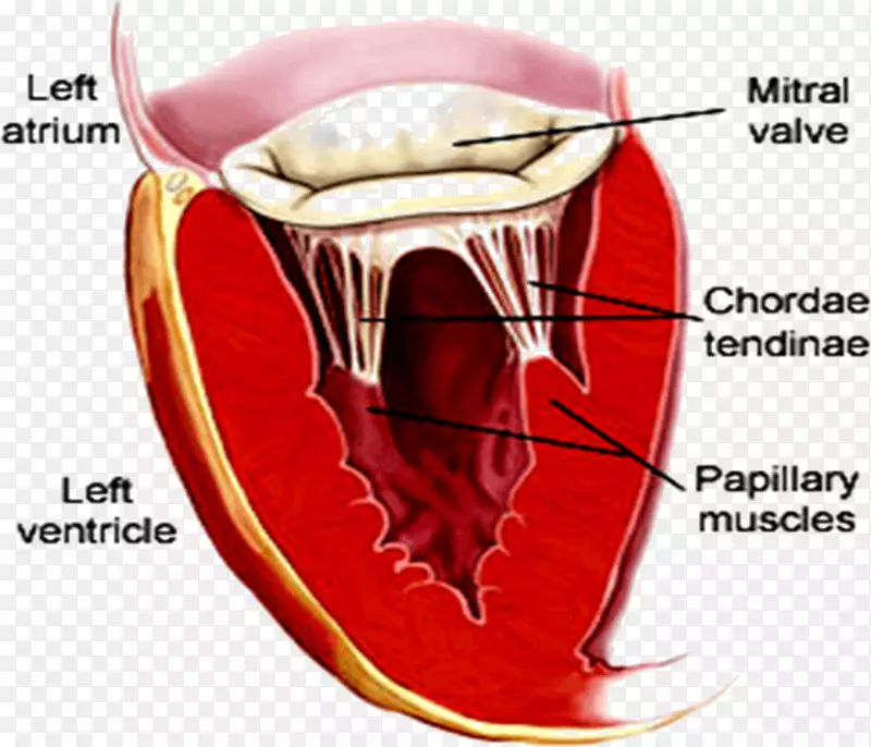 二尖瓣狭窄，心脏瓣膜关闭不全-心脏