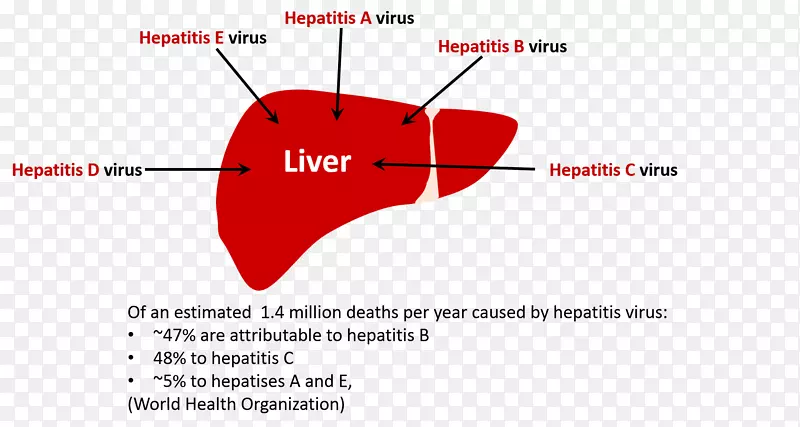 甲型病毒性肝炎丙型肝炎丁型肝炎