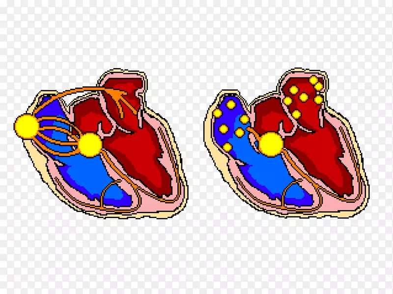 心房颤动房室传导阻滞房性心动过速-心脏