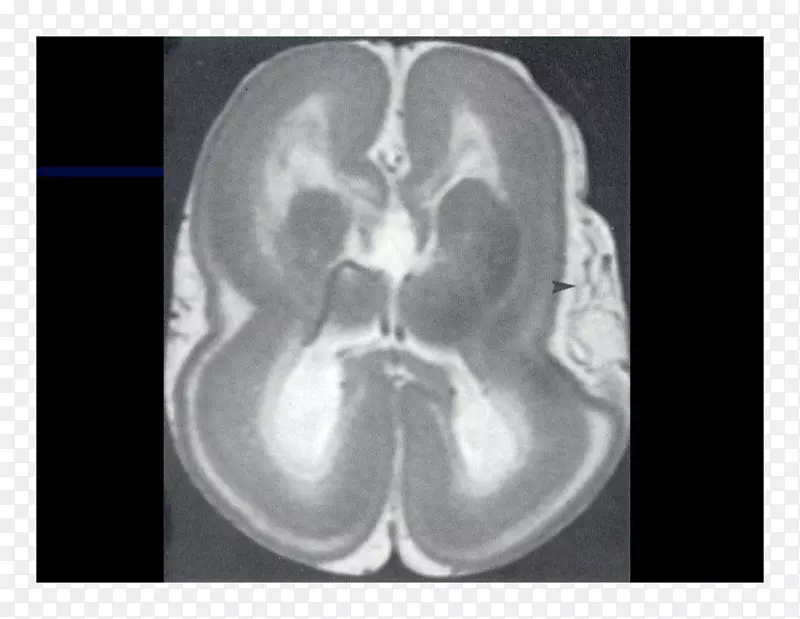 脑CT放射学磁共振成像l ketieteellinen r ntgenkuvaus-脑