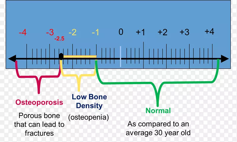骨密度双能x射线吸收骨密度测定试验分数