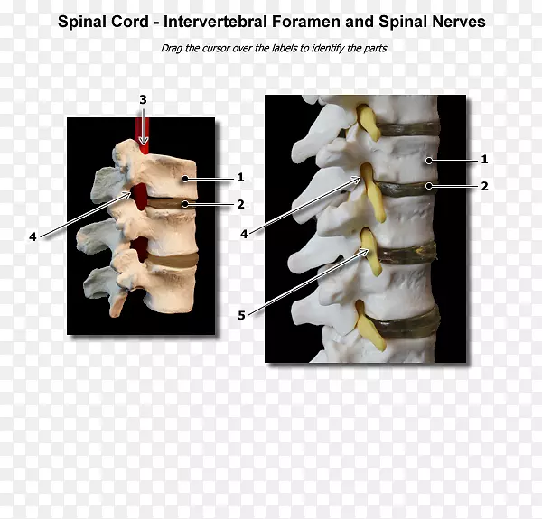 椎间孔脊髓神经
