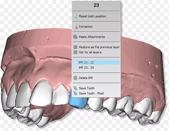 牙齿剪贴板产品手册牙科计算机软件牙科牙齿模型