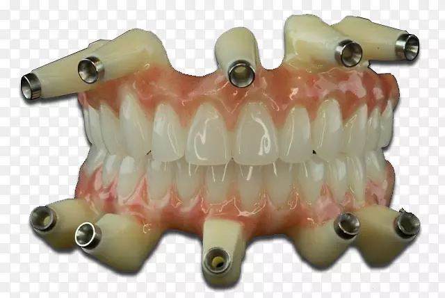 牙科实验室义齿