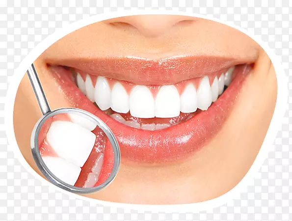 牙齿美白美容牙科人类牙齿微笑