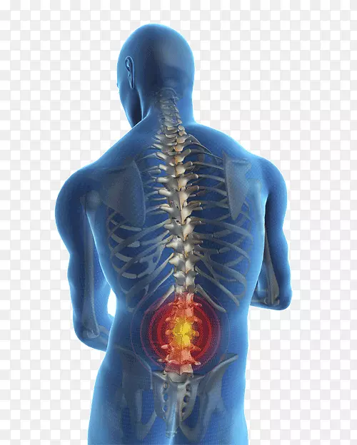腰痛腰伤人腰痛管理-腰椎间盘疾病