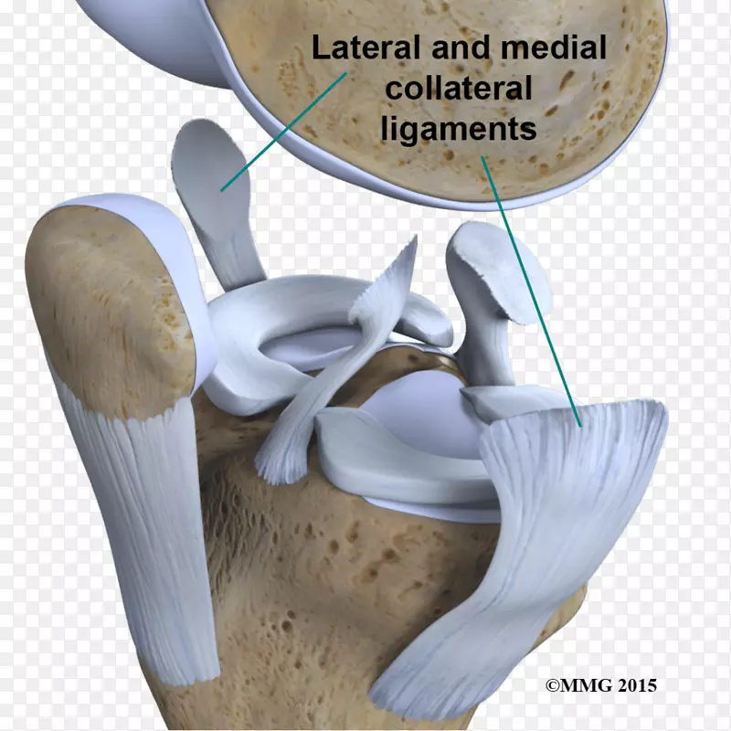 膝关节前交叉韧带损伤