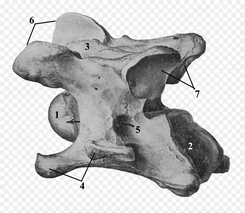 颈椎轴解剖头骨