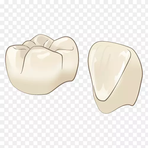 牙科治疗審美歯科牙冠