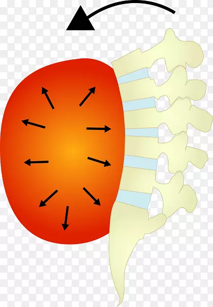 胸横膈核稳定性腰椎膈肌收缩训练