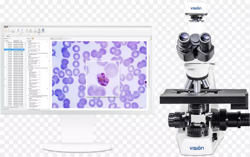 显微镜-四角疟疾技术-显微镜