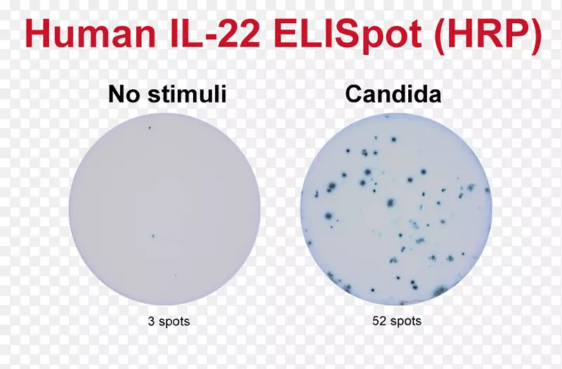ELISPOT分析b细胞颗粒酶分泌