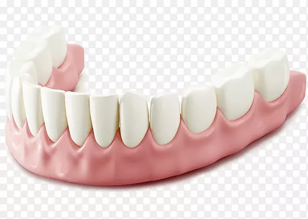牙槽成形术牙科拔牙义齿.牙龈出血