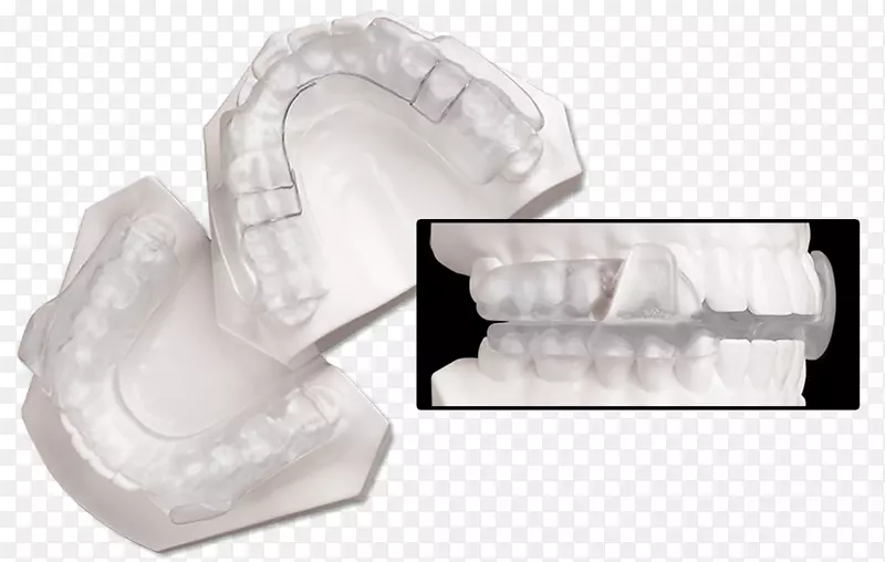 夹板颞下颌关节功能障碍牙科颌骨骨科手术
