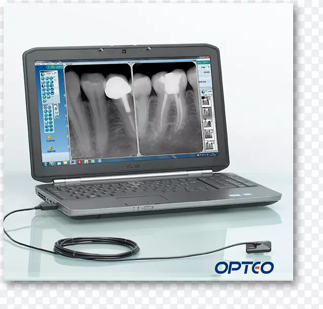 牙科放射学传感器数字射线照相牙科放射摄影.牙科医疗设备
