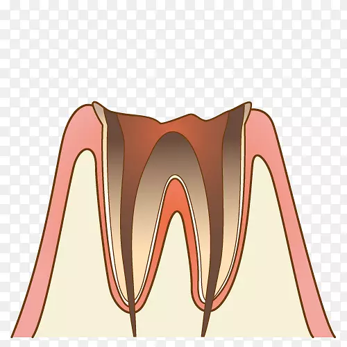 歯科牙医牙周病蛀牙洞