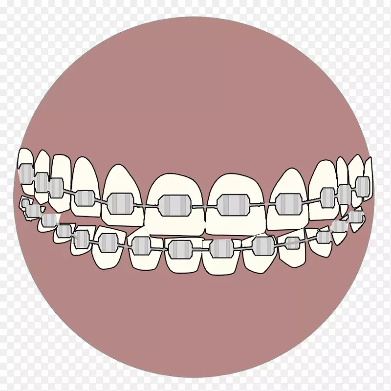 牙齿美白国际牙科磨耗空气抛光.矫形