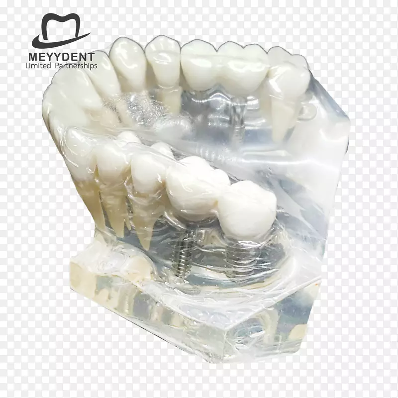 人类牙齿实验室หจก.เมย์เด้นท์颌骨-牙科模型