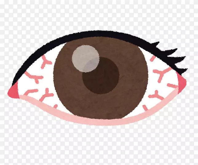 红眼大黄腺病毒角膜结膜炎-眼