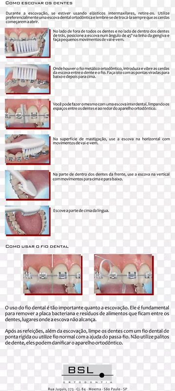 Bsl ortodontia有限公司Moema纸颌骨正畸