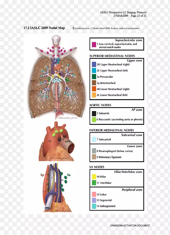 淋巴结肺癌分期解剖-肺癌