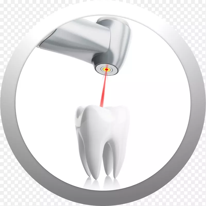 牙科激光牙科技术
