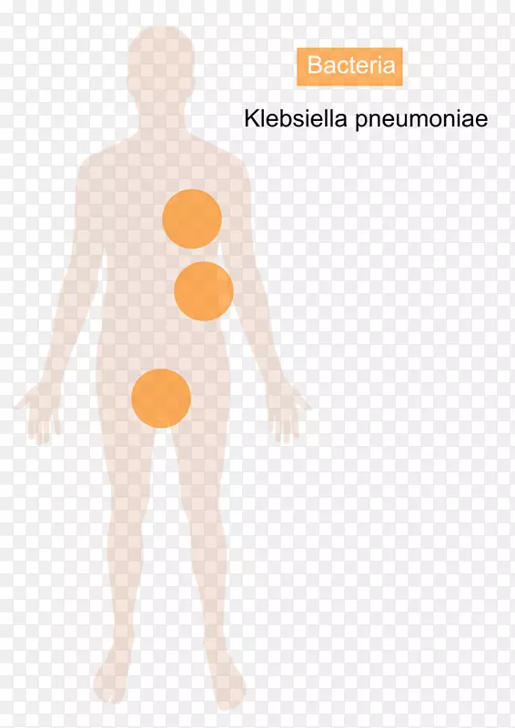 肺炎克雷伯菌(Klebsiella Oxytoca)病肺炎链球菌-细菌