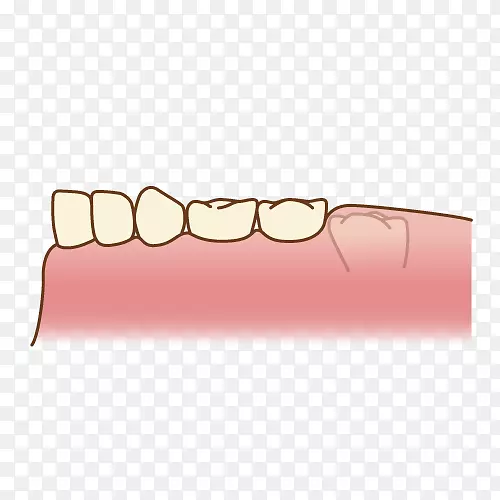 牙科磨牙-人口腔-磨牙
