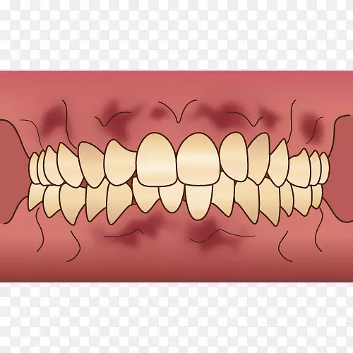 牙齿審美歯科牙医牙龈.牙科传单