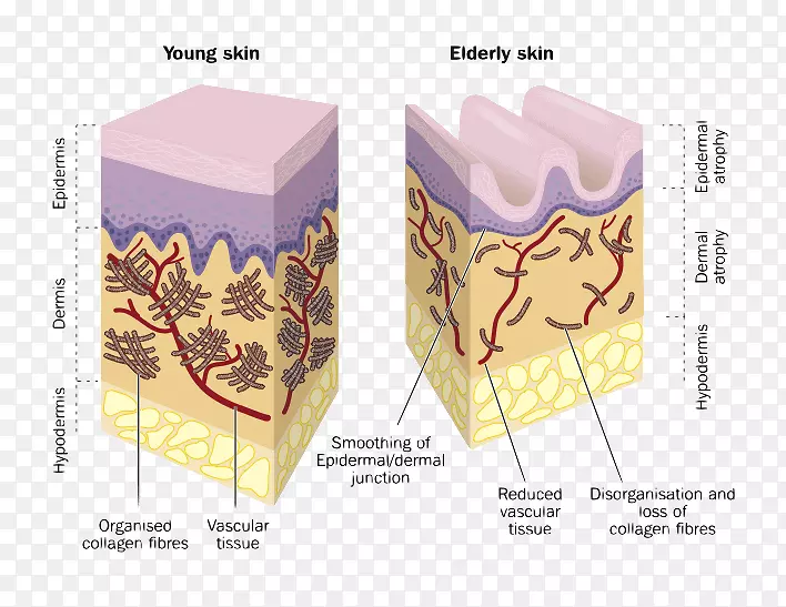 胶原蛋白皮肤皱纹透明质酸真皮-老年护理