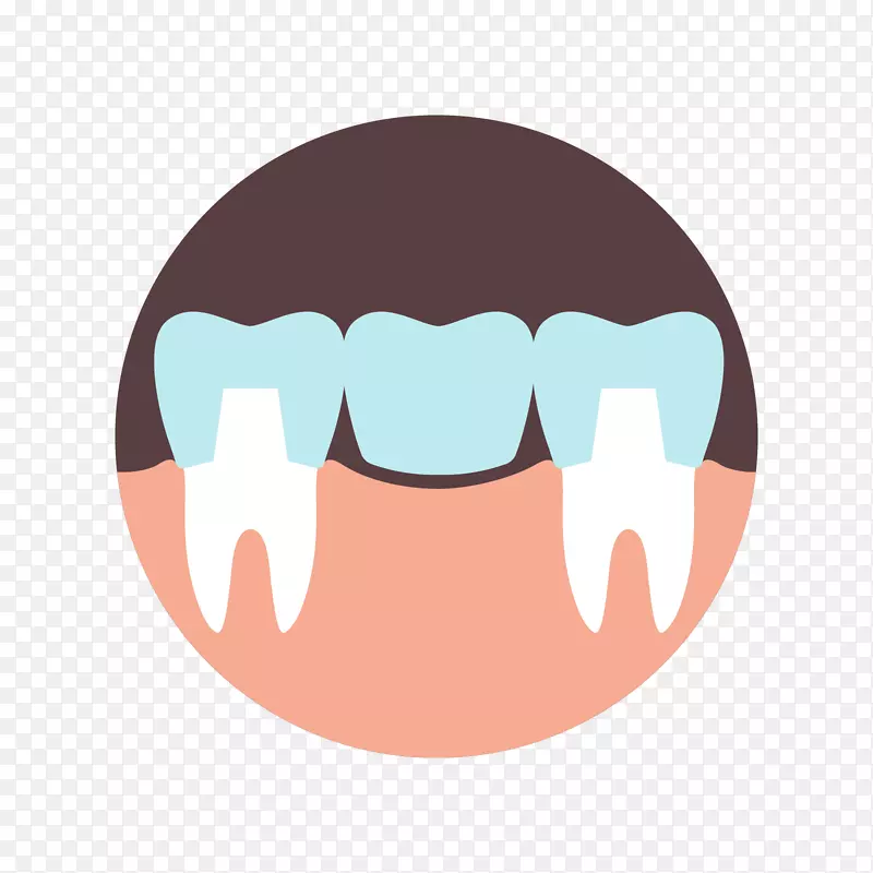 牙齿中西部牙科专家口腔修复学牙科.牙冠