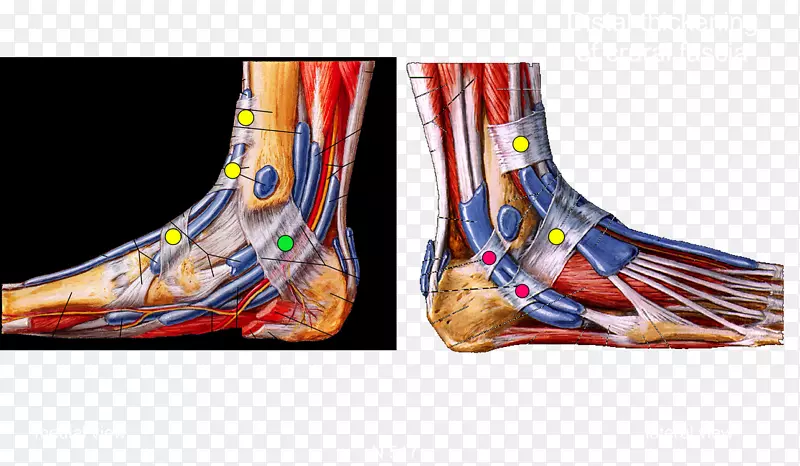 足踝人体解剖-米勒静脉
