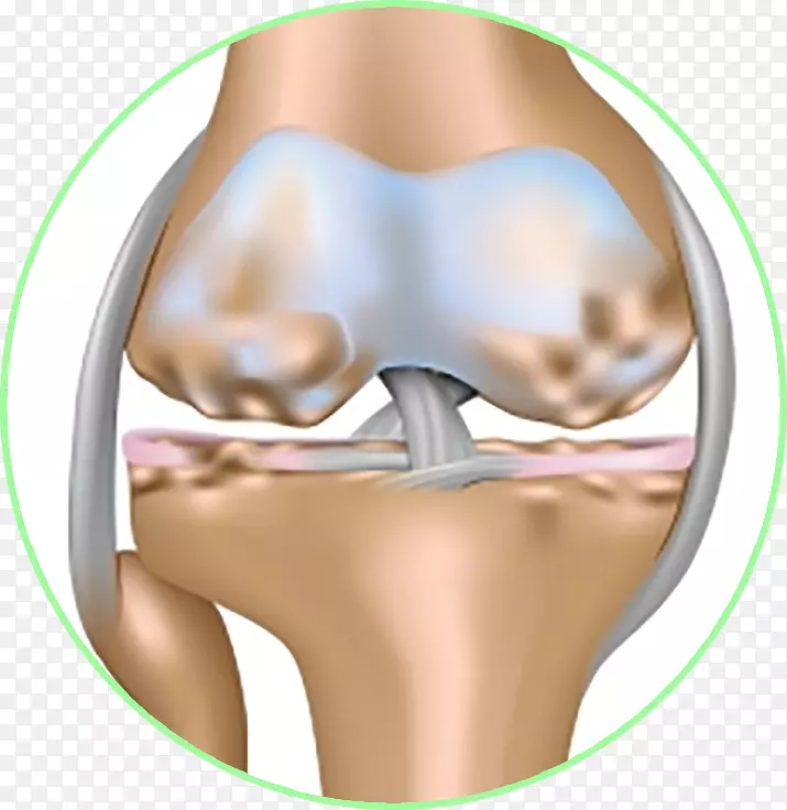 骨关节炎、关节积液、膝关节积液-khop