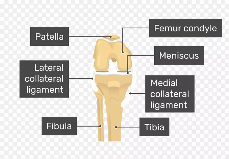 髌骨膝内侧髁-髌腱炎
