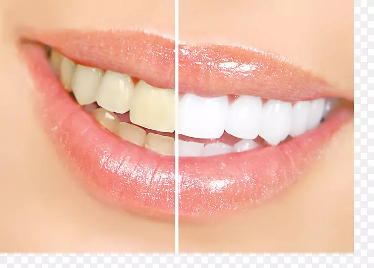 博士Azer VIP牙科：soherazer，dds牙齿美白美容牙科-发现义齿中心