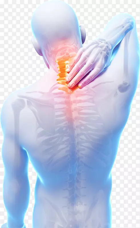 颈部疼痛肌筋膜疼痛综合征肌肉疼痛慢性疼痛
