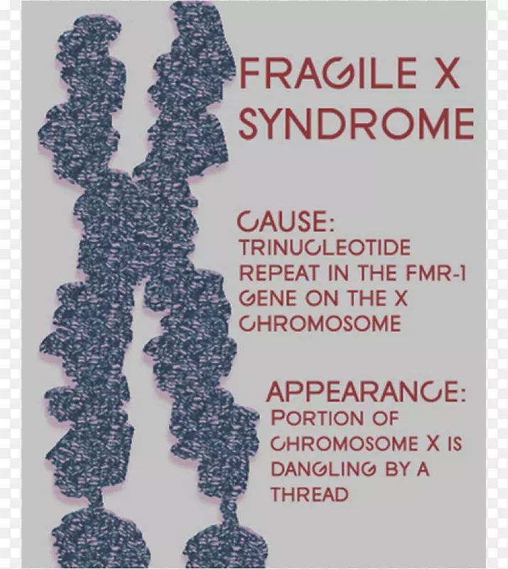 脆性x综合征智力残疾遗传紊乱22q13缺失综合征-脆性x综合征
