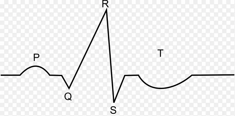 心电图解释心电图心房颤动夹AR-EKG