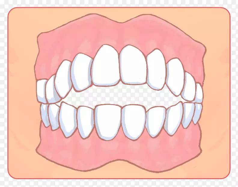 矯正歯科牙科支架牙医牙科治疗-胫骨