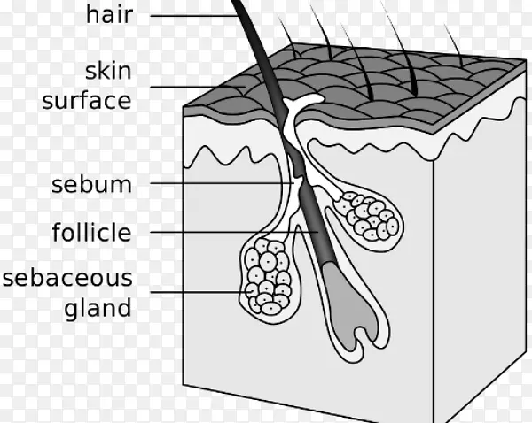 毛囊皮脂腺痤疮嵌顿系统-毛囊