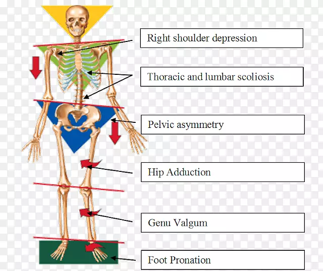 膝痛、平足、髌股痛综合征-瑜伽训练