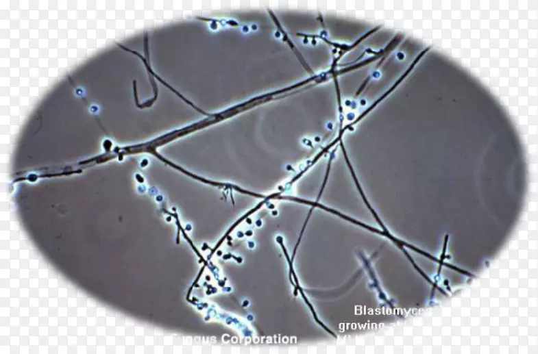 真皮芽鞘菌母细胞病白色皮埃德拉显微镜
