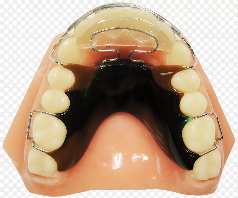 Roa-理光正畸器械，牙齿保持器，正畸，牙科.固位器