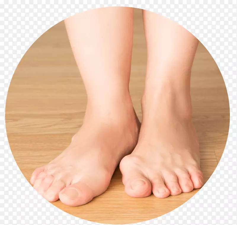 足底炎足趾足底筋膜炎足